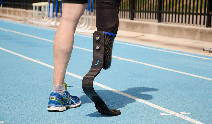 Prótesis deportiva para corredores