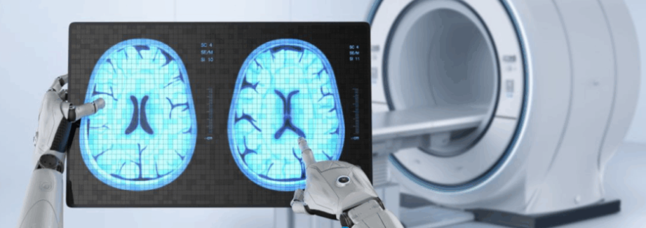 Brazo robótico señalando imágenes cerebrales en una pantalla junto a un equipo de resonancia magnética, simbolizando el uso de inteligencia artificial en el análisis médico personalizado.