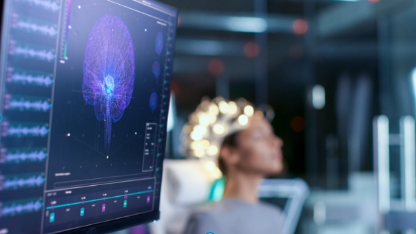 Pantalla con un escáner de actividad cerebral mientras una persona realiza una sesión de neurofeedback, simbolizando el entrenamiento del cerebro mediante tecnología en tiempo real.